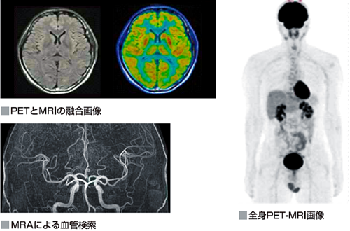 写真：腫瘍ドック